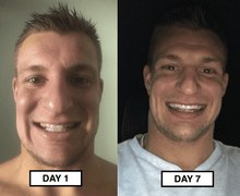 Load image into Gallery viewer, Snow® At-Home Teeth Whitening (ALL-IN-ONE KIT)