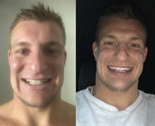 Load image into Gallery viewer, Special Offer - SNOW Teeth Whitening™ System