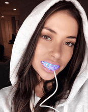 Load image into Gallery viewer, SNOW TEETH WHITENING™ SYSTÈME À DOMICILE [KIT TOUT-EN-UN]
