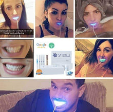 Load image into Gallery viewer, SNOW TEETH WHITENING™ – SYSTEM DO WYBIELANIA ZĘBÓW W DOMU [ZESTAW WSZYSTKO W JEDNYM]
